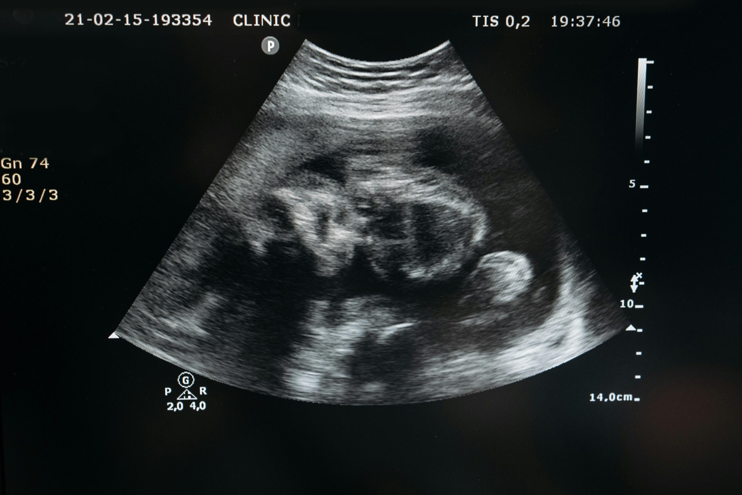 ultrasound_1